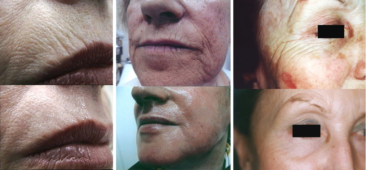 fractional_ba_02-min